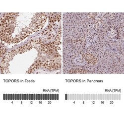TOPORS Antibody, Novus Biologicals:Antibodies:Primary Antibodies